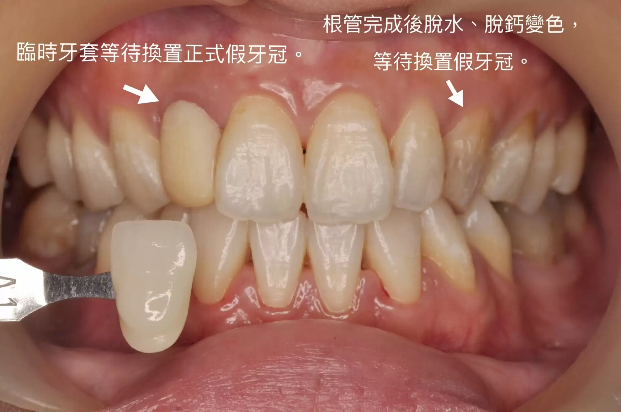 proimages/IMG_0340.JPG proimages/IMG_0340.JPG