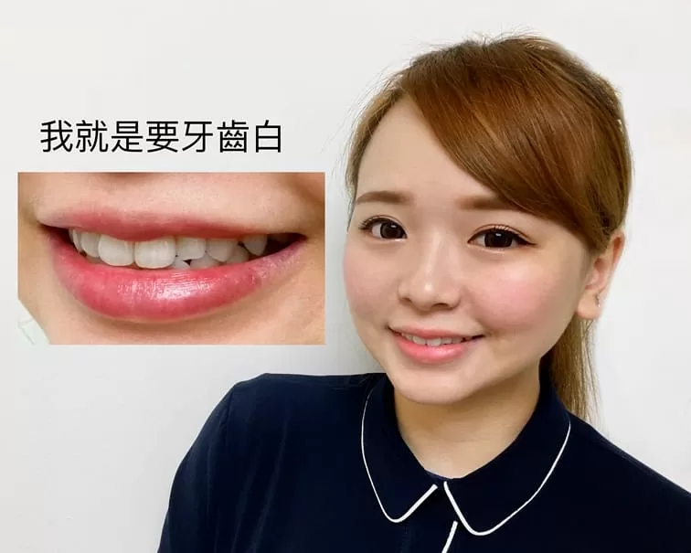 牙齒美白療程內容是什麼? 牙齒美白療程內容是什麼?