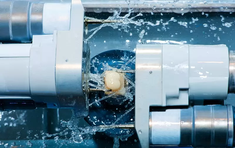 不需等待，一個診次完成牙齒美觀與功能