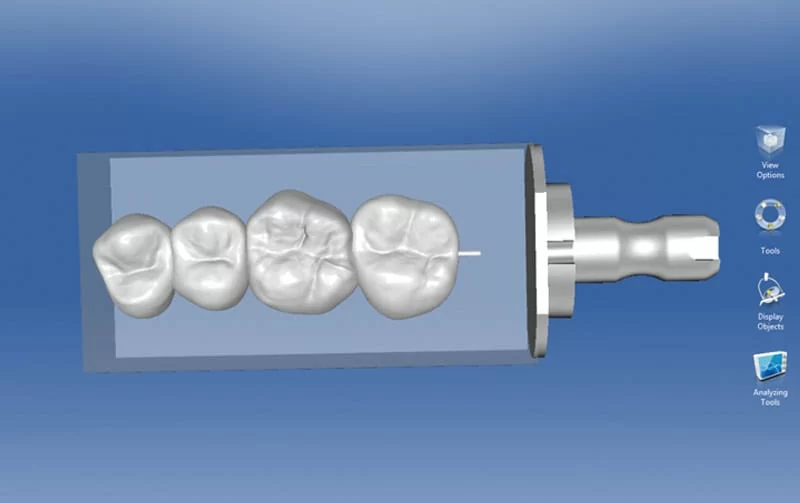 人工智慧3D軟體設計與補綴體研磨前預覽