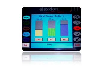 數位智慧雷射內建超過100個牙科雷射臨床模式