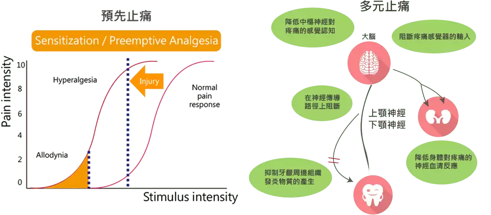 TCI 舒眠牙醫治療