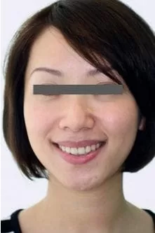 整合性牙齒美容,擁有微笑曲線展現潔白健康齒色 整合性牙齒美容,擁有微笑曲線展現潔白健康齒色