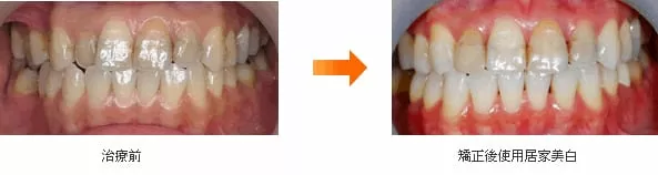 全口合併矯正、牙周、植牙、假牙治療 全口合併矯正、牙周、植牙、假牙治療