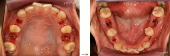 矯正牙齒,排列整齊恢復美觀與健康 矯正牙齒,排列整齊恢復美觀與健康