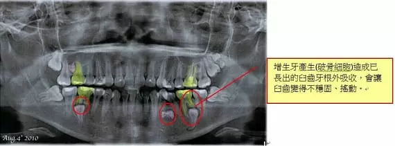 矯正牙齒,排列整齊恢復美觀與健康 矯正牙齒,排列整齊恢復美觀與健康