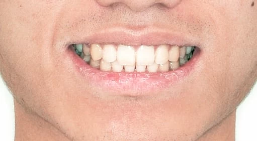 再也不需要自拍神器也可以很帥了 再也不需要自拍神器也可以很帥了