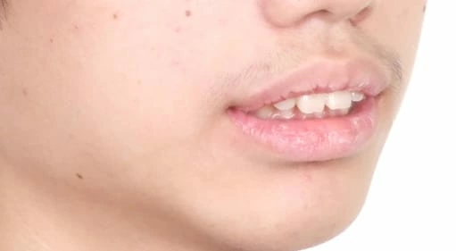 再也不需要自拍神器也可以很帥了 再也不需要自拍神器也可以很帥了