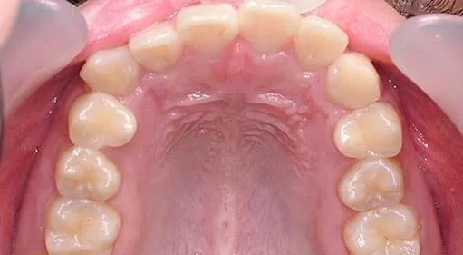 再也不需要自拍神器也可以很帥了 再也不需要自拍神器也可以很帥了