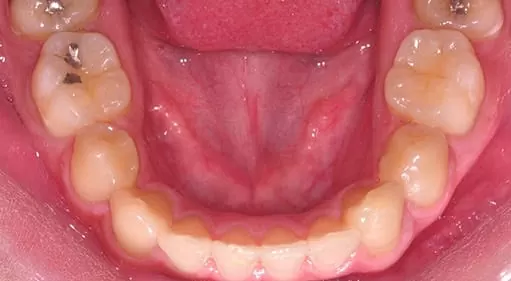 再也不需要自拍神器也可以很帥了 再也不需要自拍神器也可以很帥了