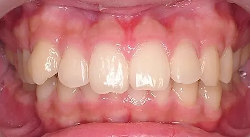 再也不需要自拍神器也可以很帥了 再也不需要自拍神器也可以很帥了