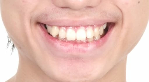 再也不需要自拍神器也可以很帥了 再也不需要自拍神器也可以很帥了