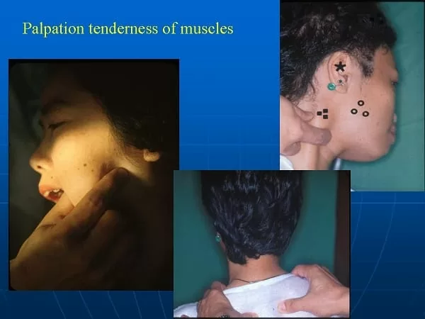 顱顎障礙症是什麼？