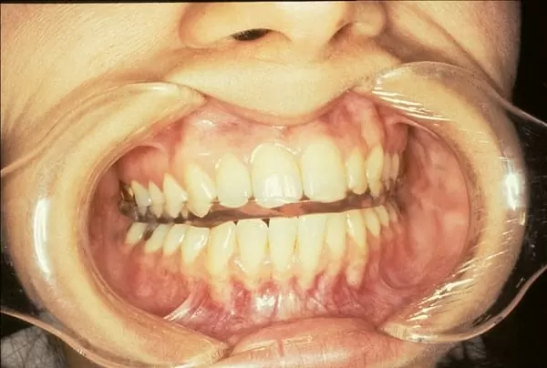 顱顎障礙症是什麼？