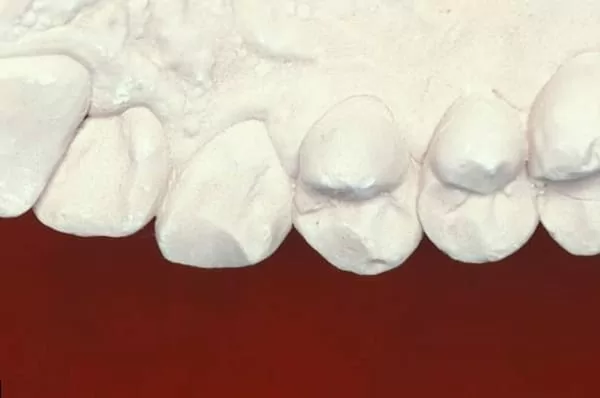 顱顎障礙症是什麼？