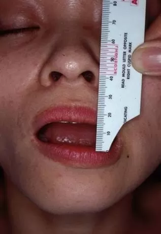 顱顎障礙症是什麼？