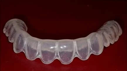 想永保潔白牙齒? 居家美白解決您的問題 想永保潔白牙齒? 居家美白解決您的問題