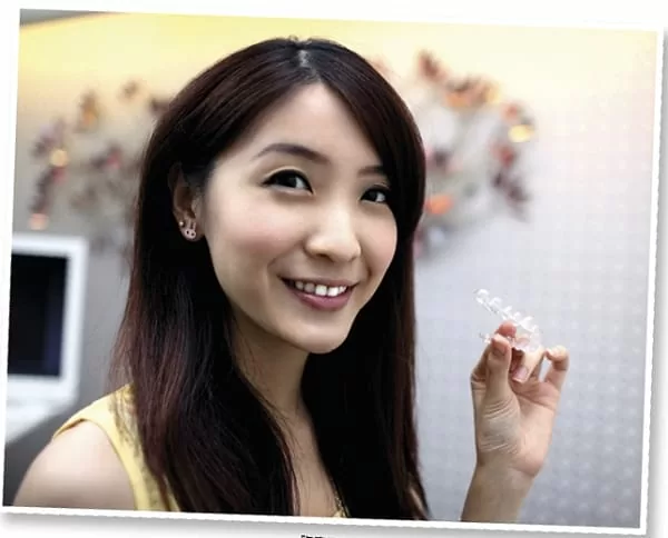 【VOGUE】隱型矯正變美的秘密 【VOGUE】隱型矯正變美的秘密