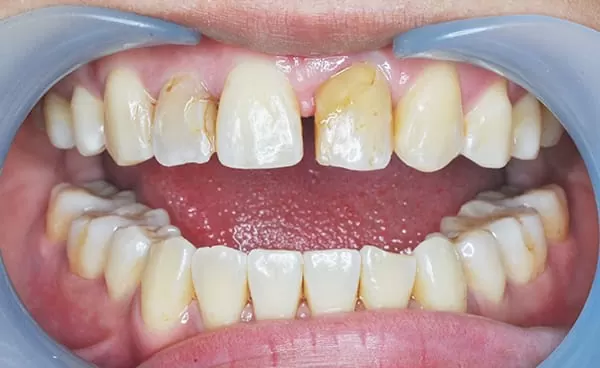 proimages/case/new-add/01.jpg proimages/case/new-add/01.jpg