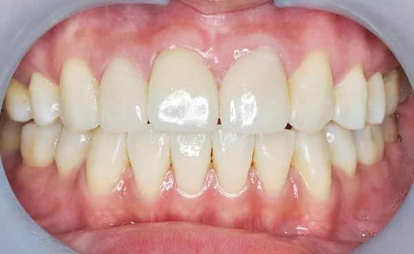 proimages/case/new-add/02.jpg proimages/case/new-add/02.jpg