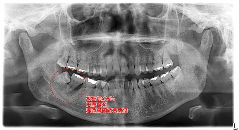 proimages/case/new-add/1-1.jpg proimages/case/new-add/1-1.jpg