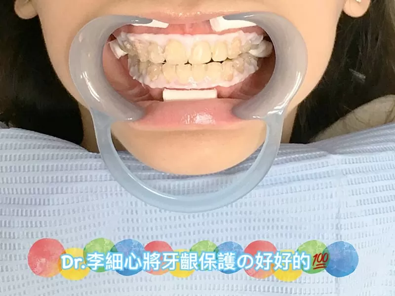 proimages/case/new-add/10.jpg proimages/case/new-add/10.jpg