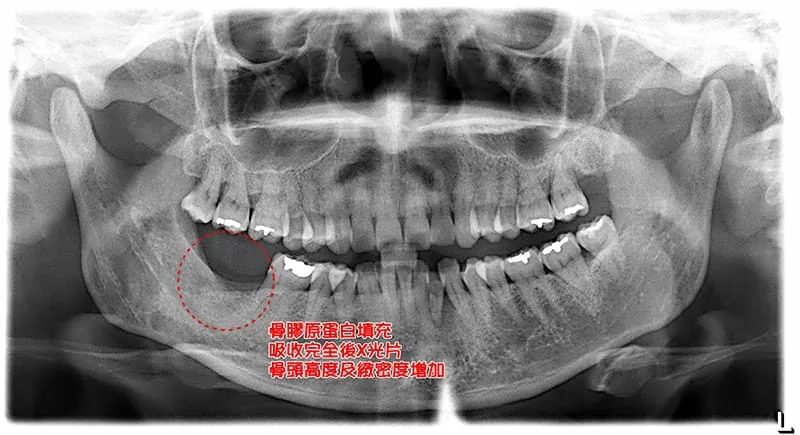 proimages/case/new-add/2-1.jpg proimages/case/new-add/2-1.jpg