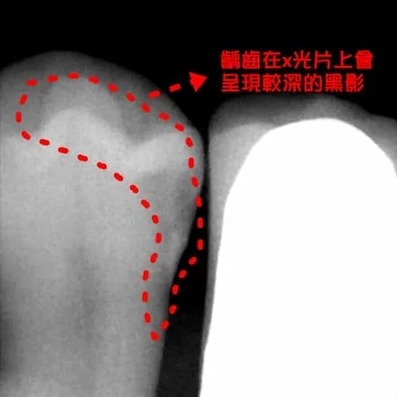 proimages/case/new-add/PA.jpg proimages/case/new-add/PA.jpg