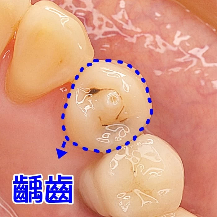 proimages/case/new-add/before.jpg proimages/case/new-add/before.jpg