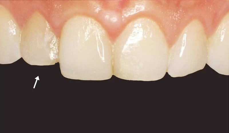 改造牙齒門面,找對醫師好重要! 改造牙齒門面,找對醫師好重要!