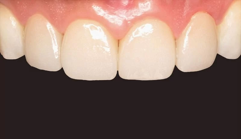 改造牙齒門面,找對醫師好重要! 改造牙齒門面,找對醫師好重要!