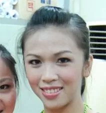 【妳的牙齒有救了】約瑟芬