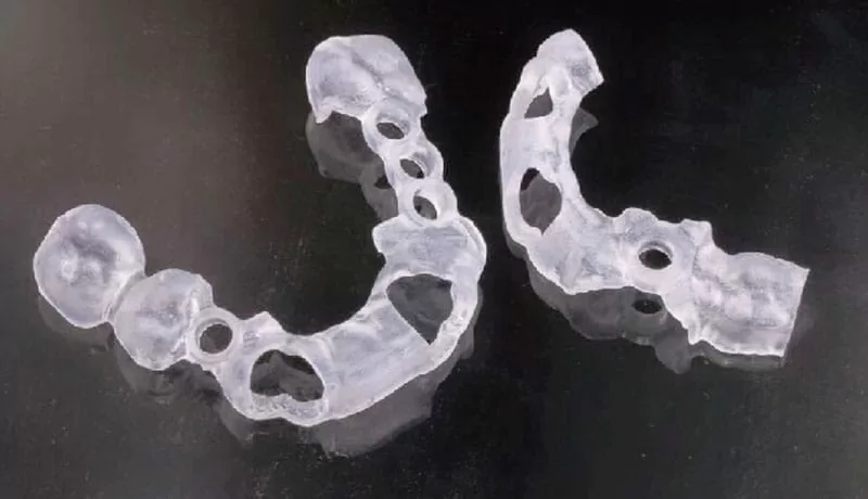 proimages/guiding-teeth-surgery/CerecGuide2_DM-1-08.jpg proimages/guiding-teeth-surgery/CerecGuide2_DM-1-08.jpg