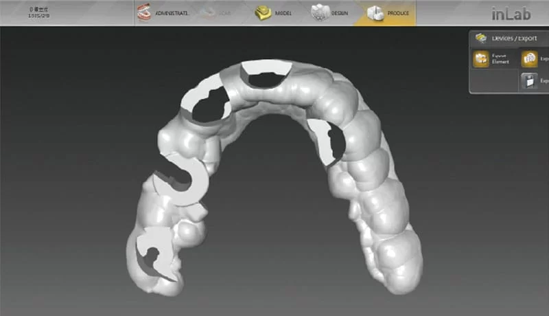 proimages/guiding-teeth-surgery/CerecGuide2_DM-1-09.jpg proimages/guiding-teeth-surgery/CerecGuide2_DM-1-09.jpg