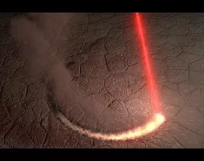 兒童預防蛀牙 - 臼齒溝隙封填 兒童預防蛀牙 - 臼齒溝隙封填