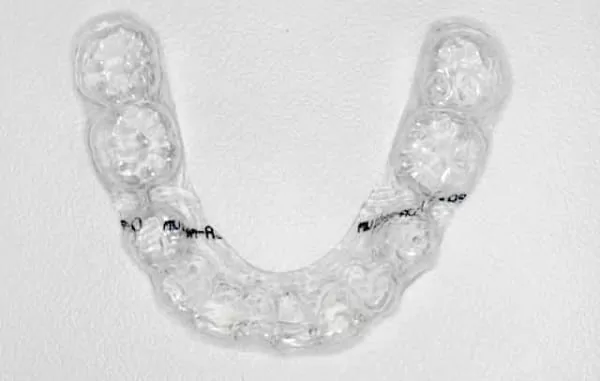 透明隱形矯正器 隱形矯正SOS 透明隱形矯正器 隱形矯正SOS