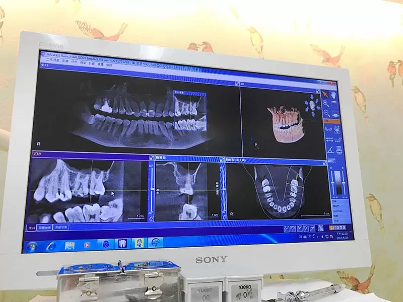 proimages/news/add04/20.jpg proimages/news/add04/20.jpg