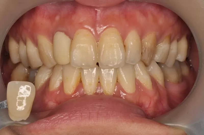 proimages/news/add04/3.jpg proimages/news/add04/3.jpg