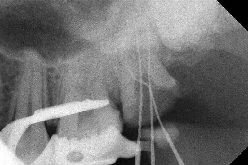 proimages/news/add05/4.jpg proimages/news/add05/4.jpg