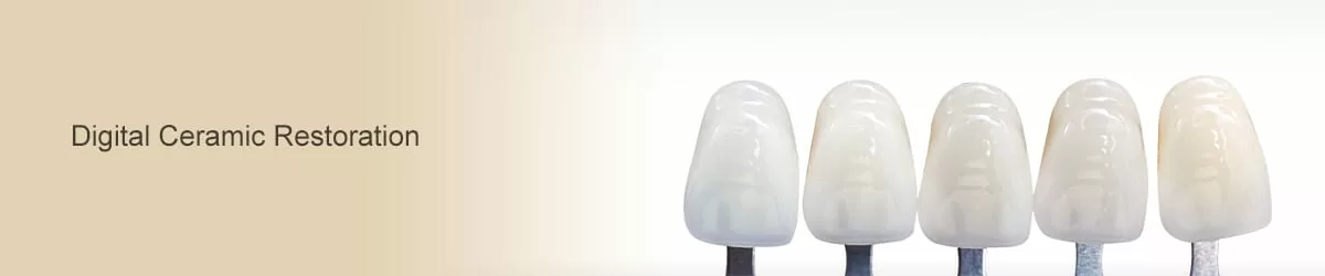台北數位瓷牙/台北全瓷牙冠專家 台北數位瓷牙/台北全瓷牙冠專家