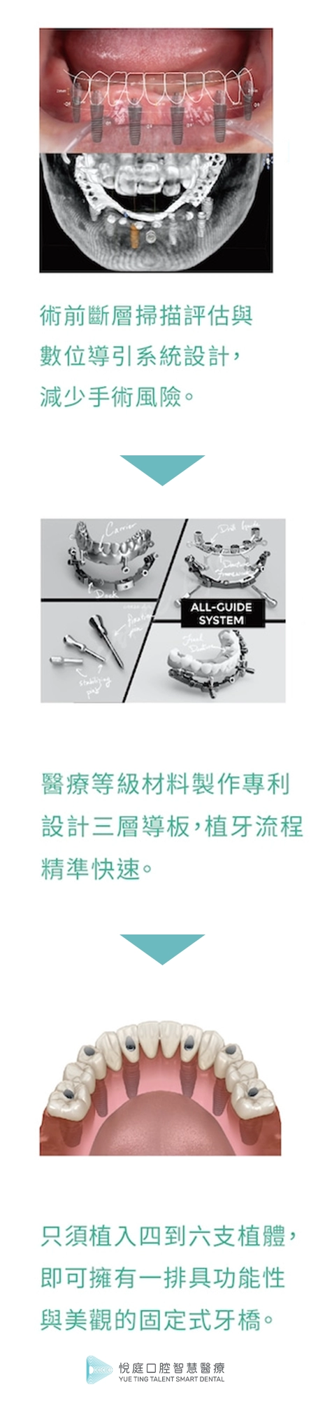 BIO-ALL-X 碧歐適全口重建 BIO-ALL-X 碧歐適全口重建