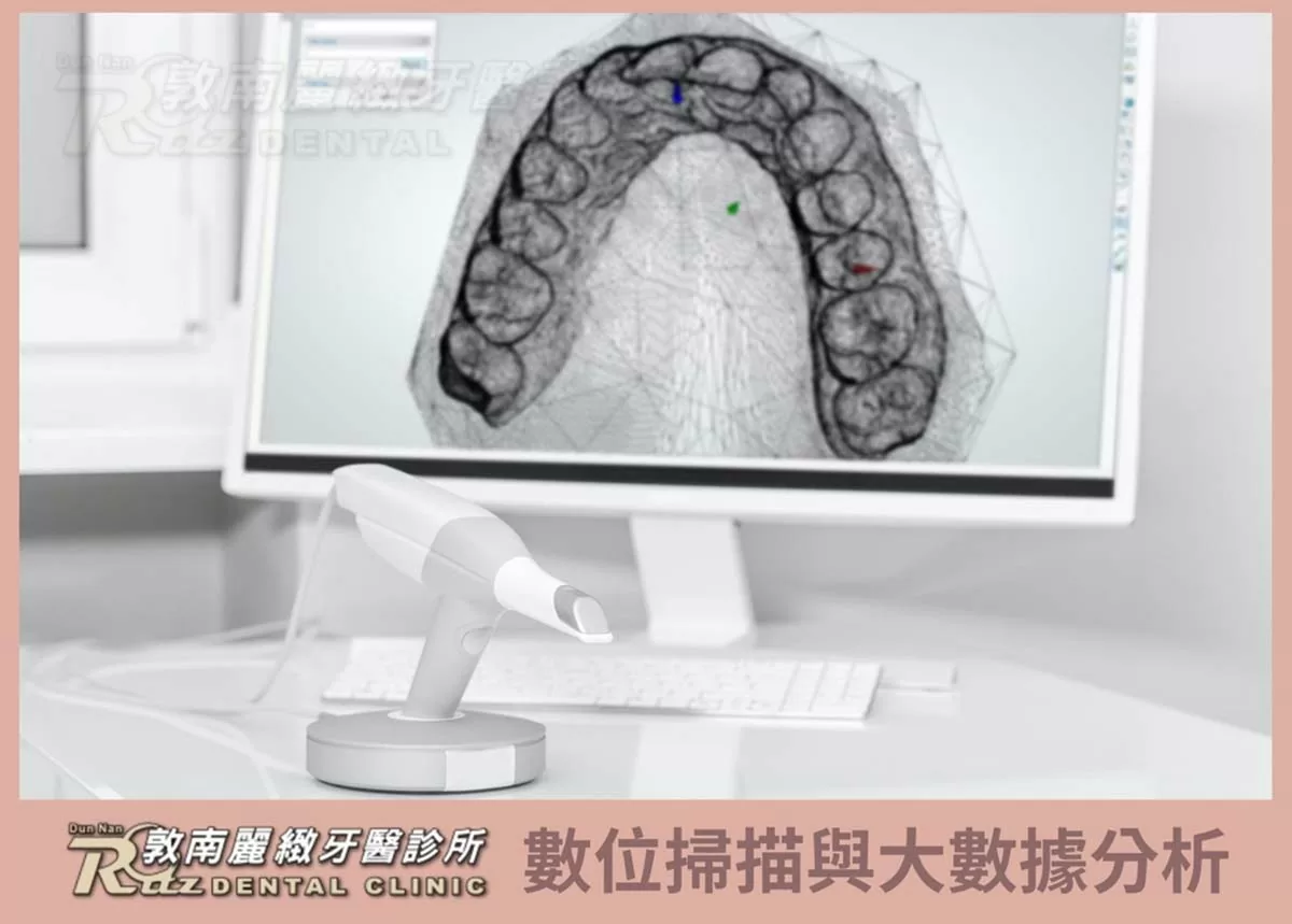 隱適美隱形矯正 隱適美隱形矯正